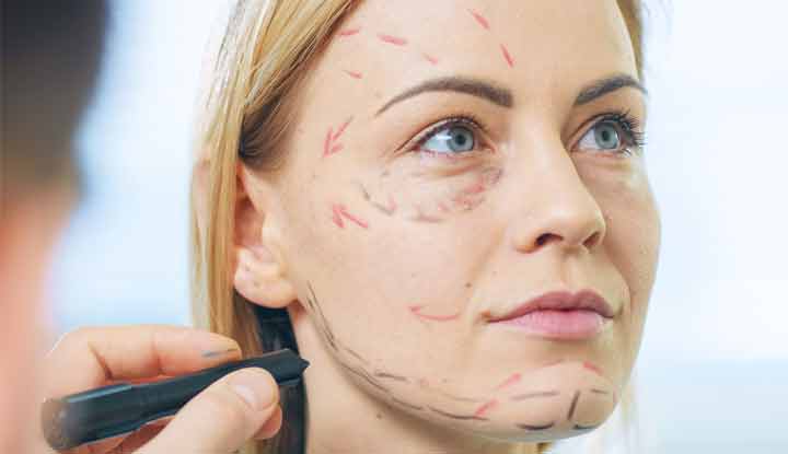 What to Expect During Facelift Recovery