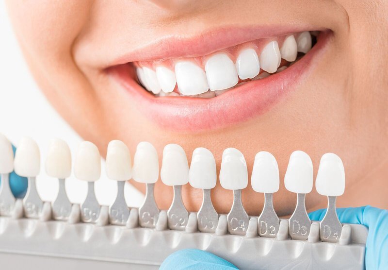 How to Improve Your Smile: 5 Easy Tips